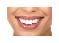 کاشت ایمپلنت دندان و درمان های دندانپزشکی زیبایی